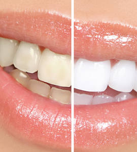 POWER BLEACHING